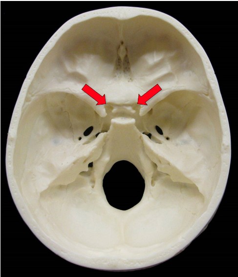 <p>Which Cranial Nerve passes through the optical canal of the sphenoid bone?</p>