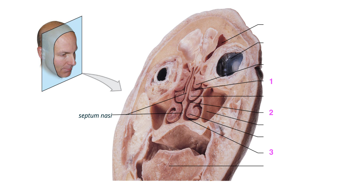 <p>1: neusgang die zorgt voor afvoer van neusbijholten.</p>