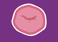 <p>Opening connecting internal organ to outside body </p>