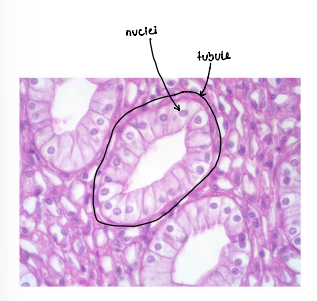 term image