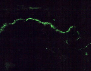 <p><span>Uniform line along basement membrane</span></p>