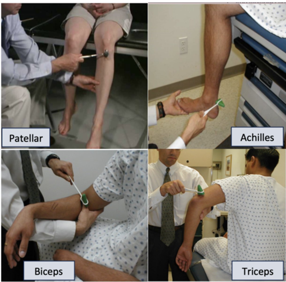 <p>patellar reflex, biceps reflex, triceps reflex</p>