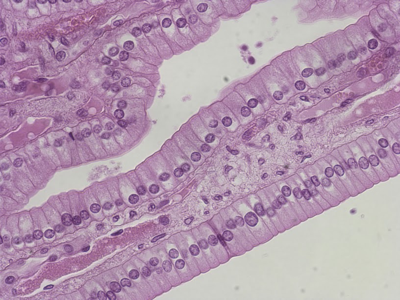 <p>Simple Columnar Epithelium</p>