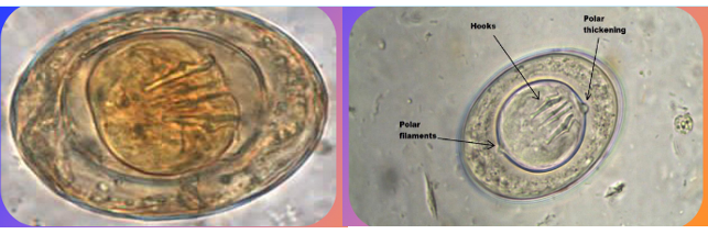 <ul><li><p><span><strong><u>Polar filaments present</u></strong></span></p></li><li><p><span>More oval than round</span></p></li><li><p><span>Hooked oncosphere with 6 hooks</span></p></li><li><p><span>Size 47 x 57 um</span></p></li></ul><p></p>