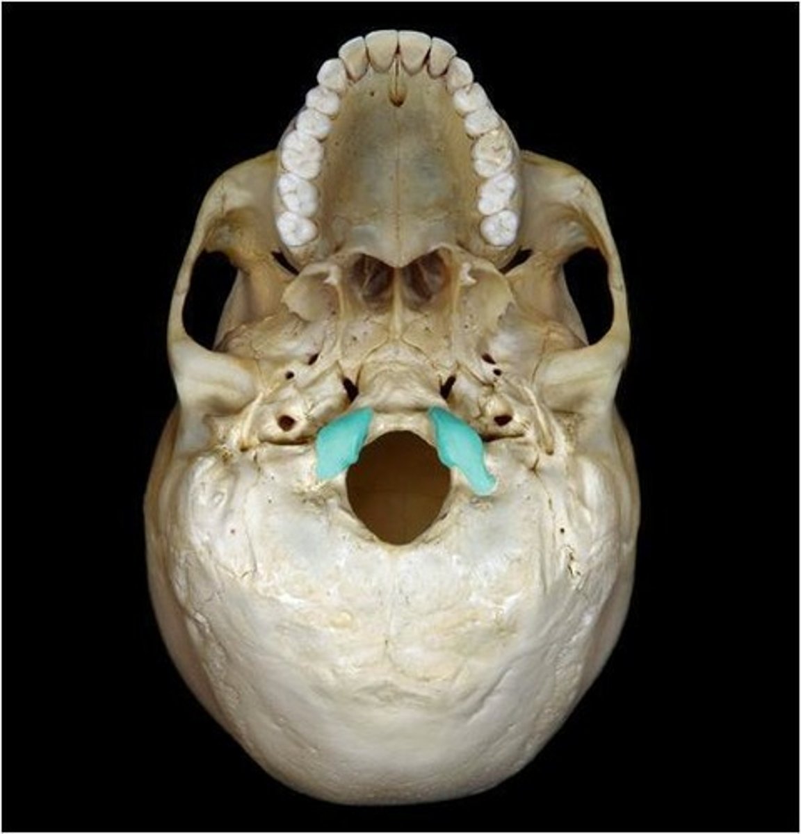 <p>each of two rounded knobs on the occipital bone that form a joint with the first cervical vertebra.</p>