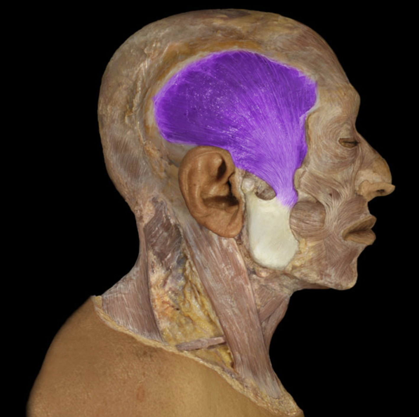 <p>What is/are this muscle’s origin(s)?</p>