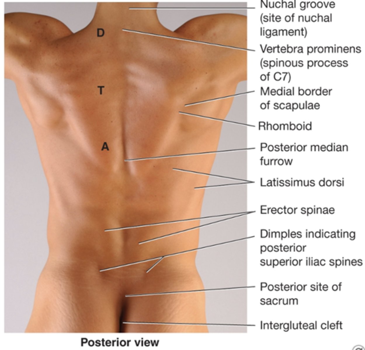 <p>site of nuchal ligament in the back</p>