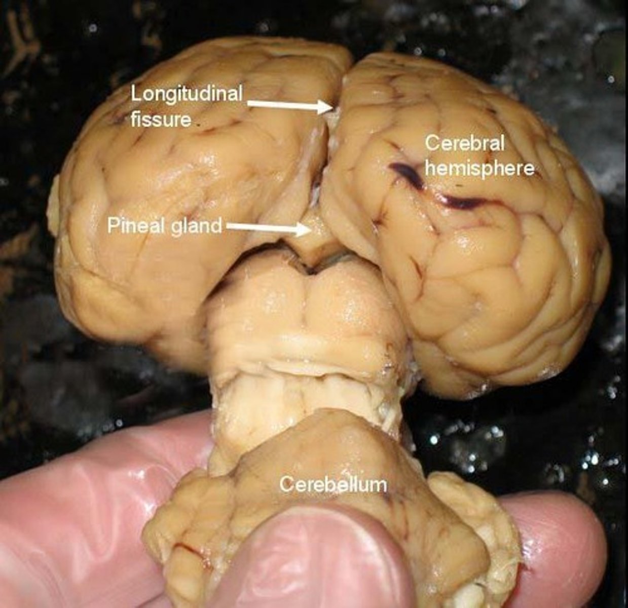 <p>It secretes melatonin to regulate circadian rhythms and sleep cycles.</p>