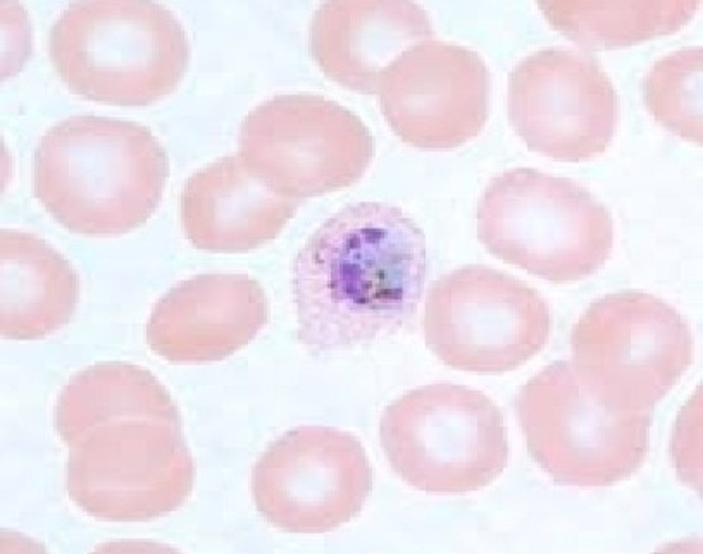 <p>• Retics infected (large RBCs)</p><p>• Ring forms >1/3 size of RBC</p><p>• Mature troph more compact than P. vivax "</p><p>o "Comet forms"</p><p>• Schizont has 6-14 merozoites</p><p>• Gametocytes are large and oval</p><p>• Schuffner's dots</p>
