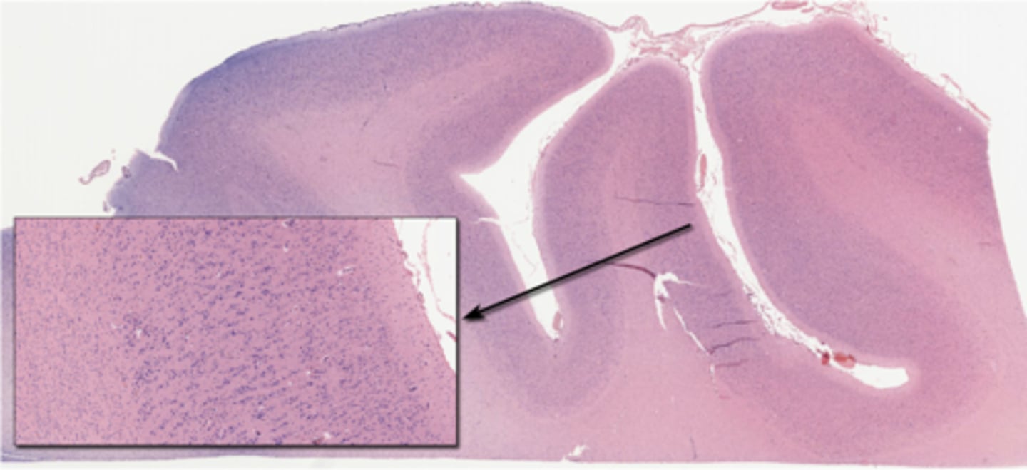 <p>Identify the specific part of the brain</p>