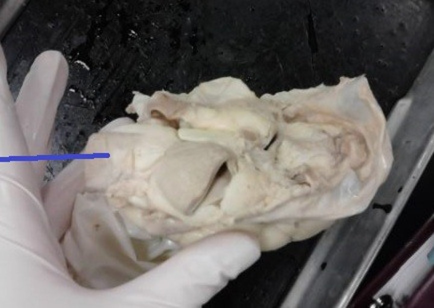 <p>Identify the blood vessel that carries blood from the head, neck, and arms of the body to the right atrium.</p>