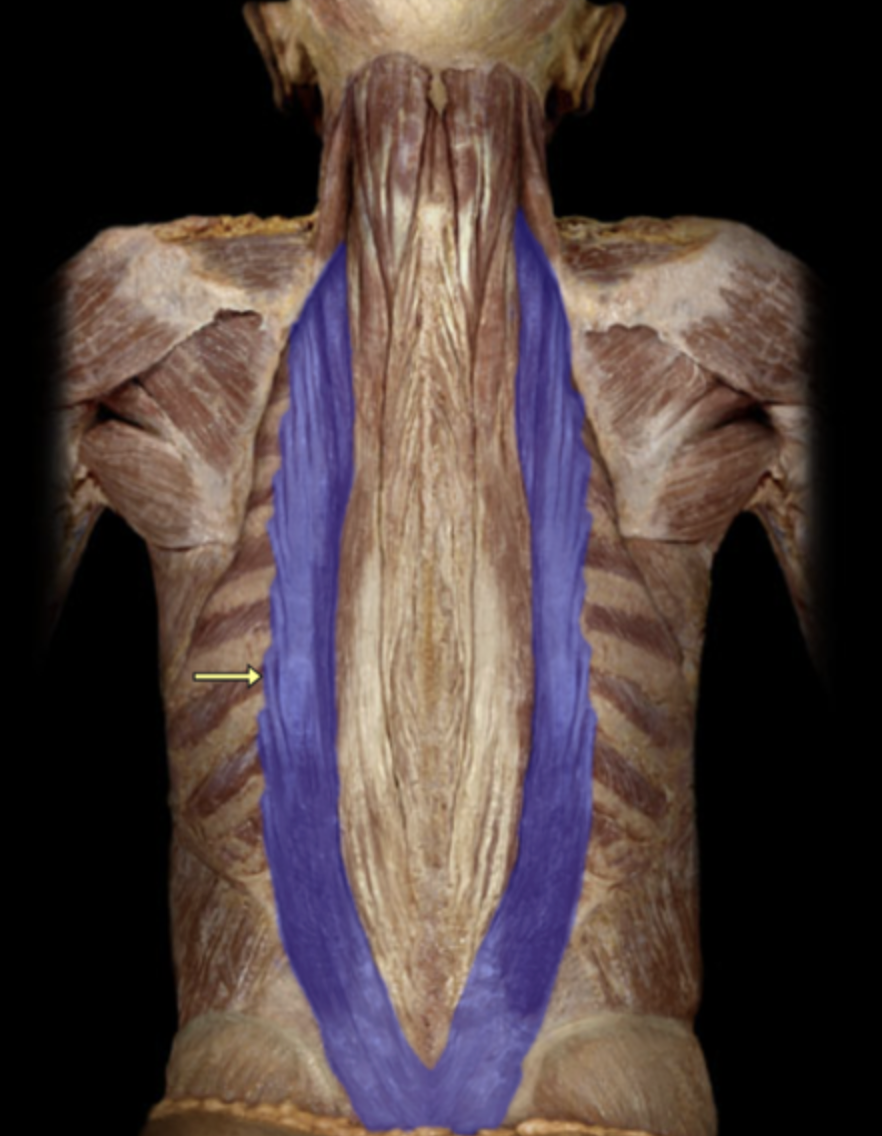 <p>Iliocostalis M.</p>