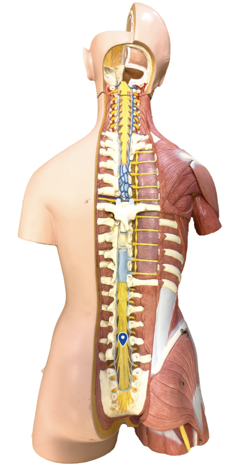 <p>What horse tail-shaped structure of the spinal cord is the arrow pointing to?</p>