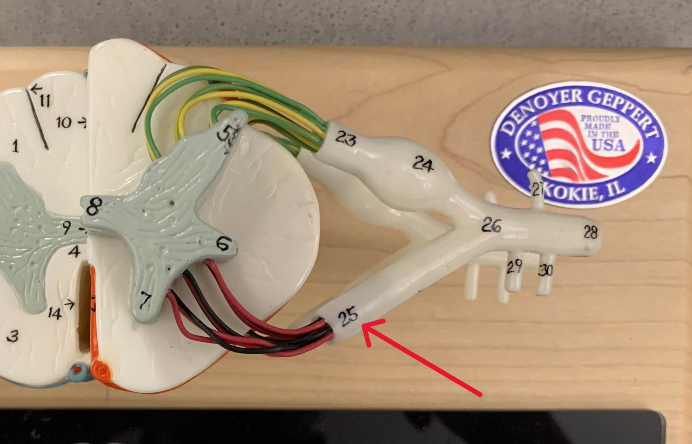 <p>Which part of the spinal cord is:</p><ul><li><p>Located on anterior side</p></li><li><p>Look like roots</p></li><li><p>Contains axons of motor neurons</p></li></ul><p></p>