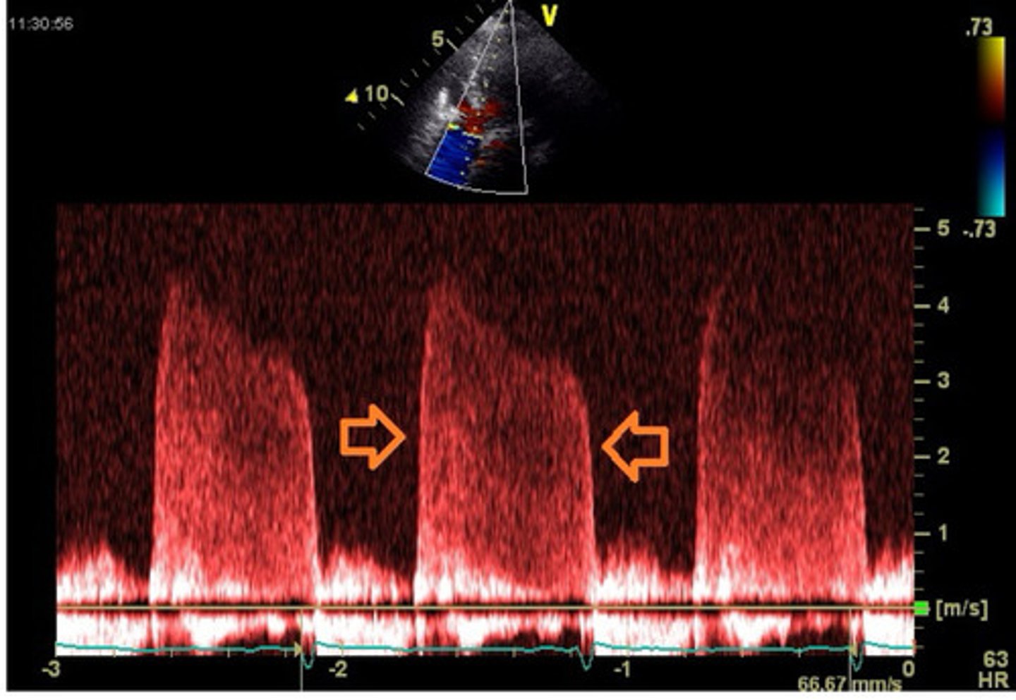 <p>What does this CW represent</p>