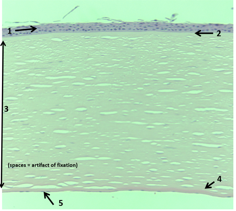 <ol><li><p>Epithelium</p></li><li><p>Bowman’s layer</p></li><li><p>Stroma</p></li><li><p>Descemet’s membrane</p></li><li><p>Endothelium</p></li></ol><p></p>