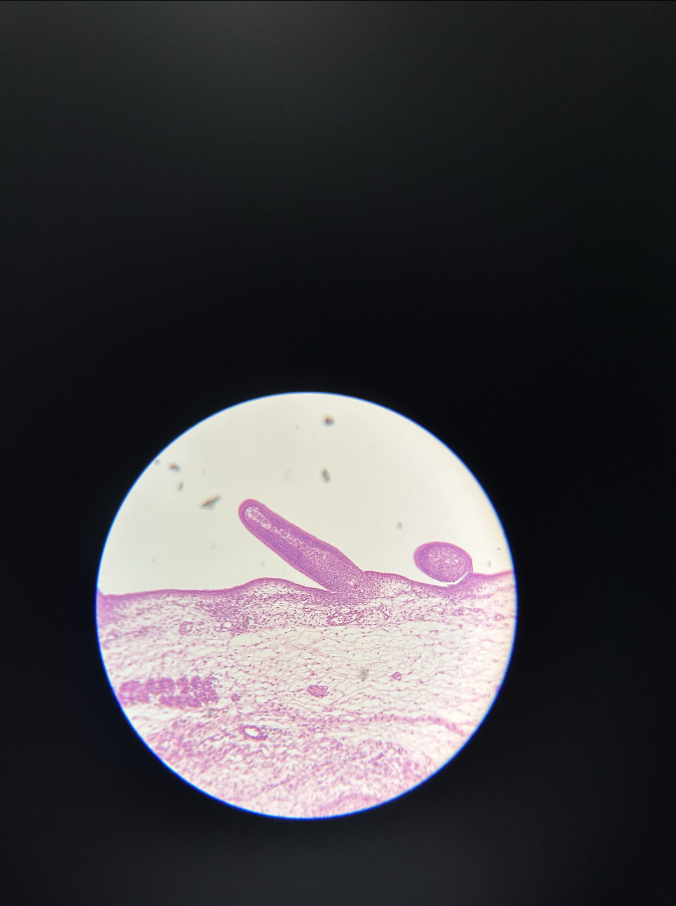 <p>what specimen is this?</p><p>identify the epidermis, dermis, blood vessel, and developing feather</p>