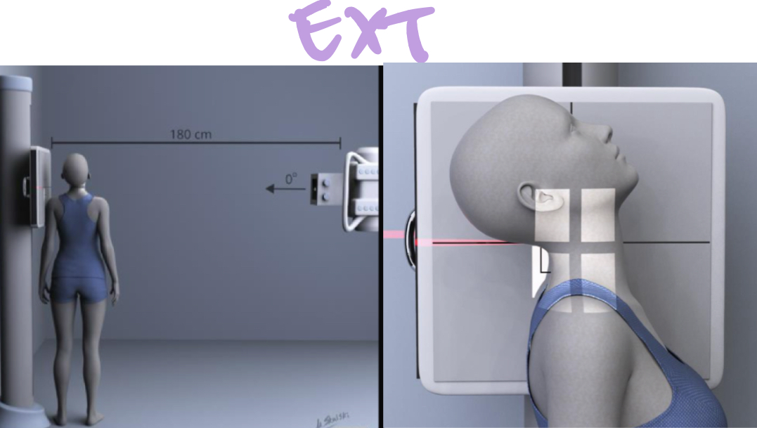<p>SID: 72”</p><p>Air Gap: YES</p><p>Cassette Size: 10×12</p><p>Collimation: less than film size</p><p>Tube tilt: N/A</p><p>Measure through: C7 level</p><p>Central ray: C4</p><p style="text-align: left">Breathing: suspend RESPIRATION</p><p style="text-align: left">*chin OUT for EXT</p>