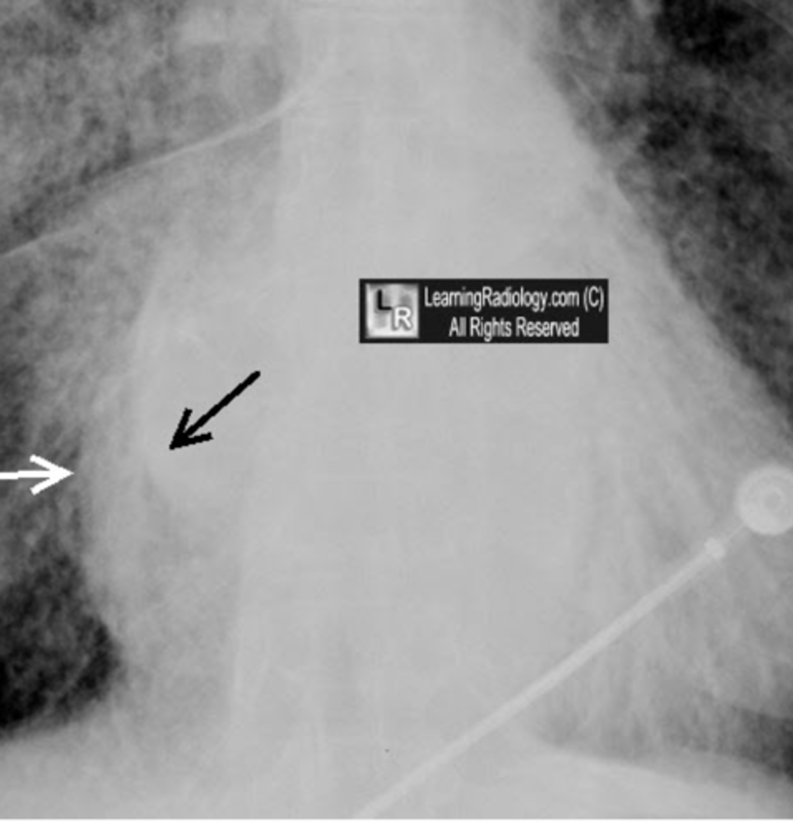 <p>what is this showing and what is it indicative of</p>