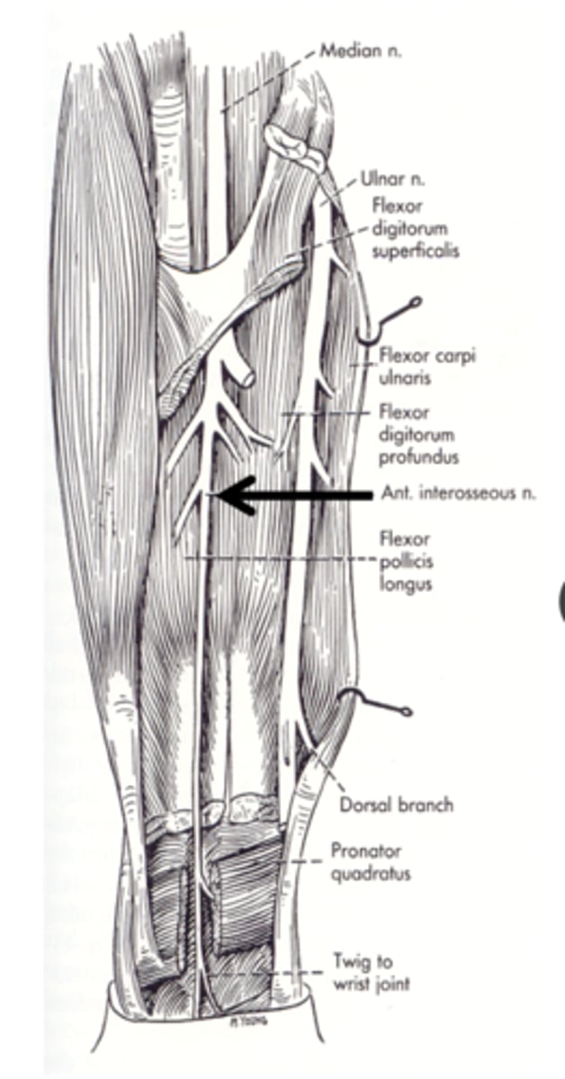 <p>median nerve within cubital fossa</p>