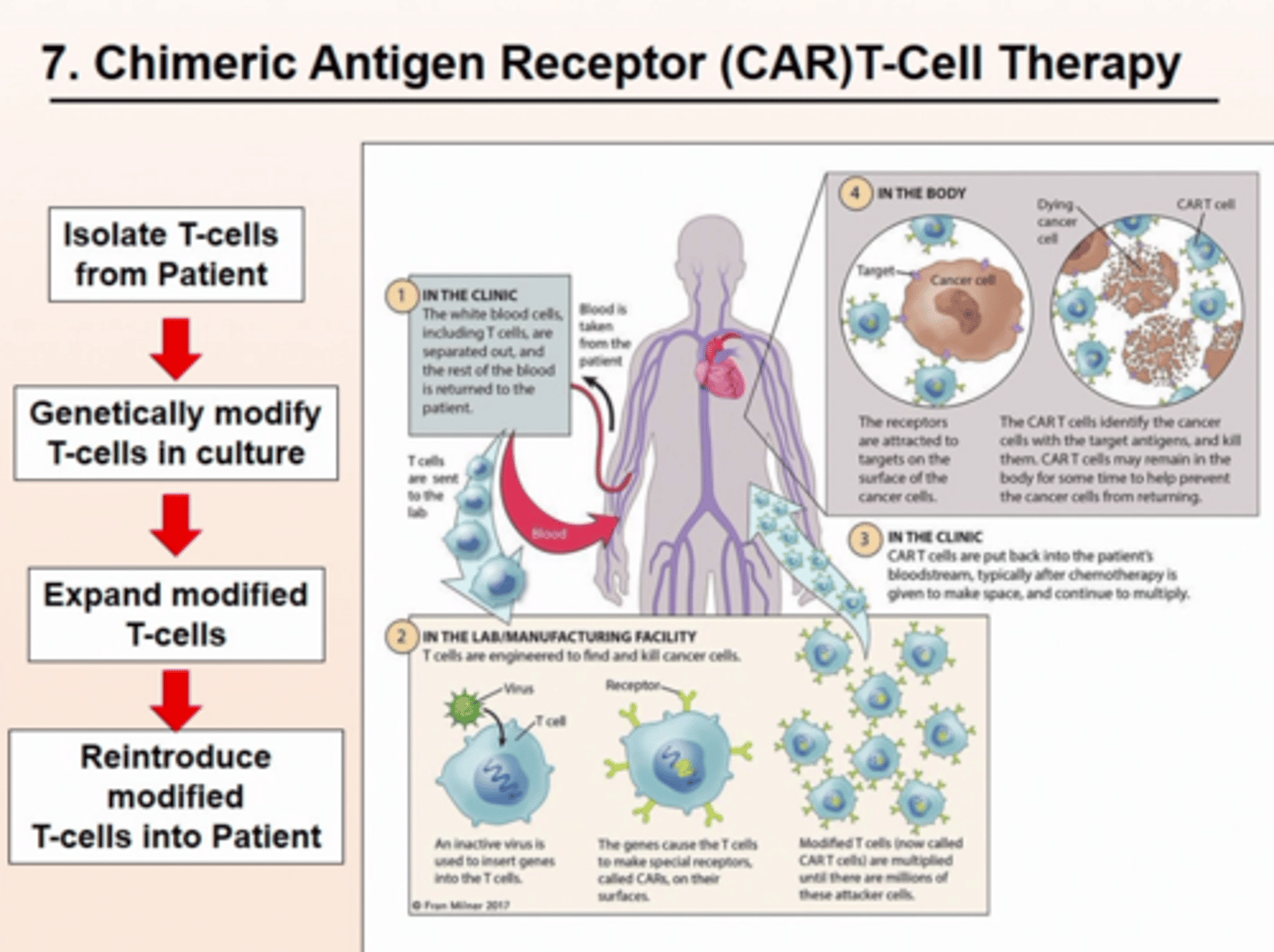 <p>CAR T-cell Therapy (KYMRIAH)</p><p>- Patient's own T cells are genetically engineered to express Chimeric Antigen Receptor (CAR) </p>