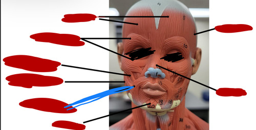 <p>What muscle is this?</p>