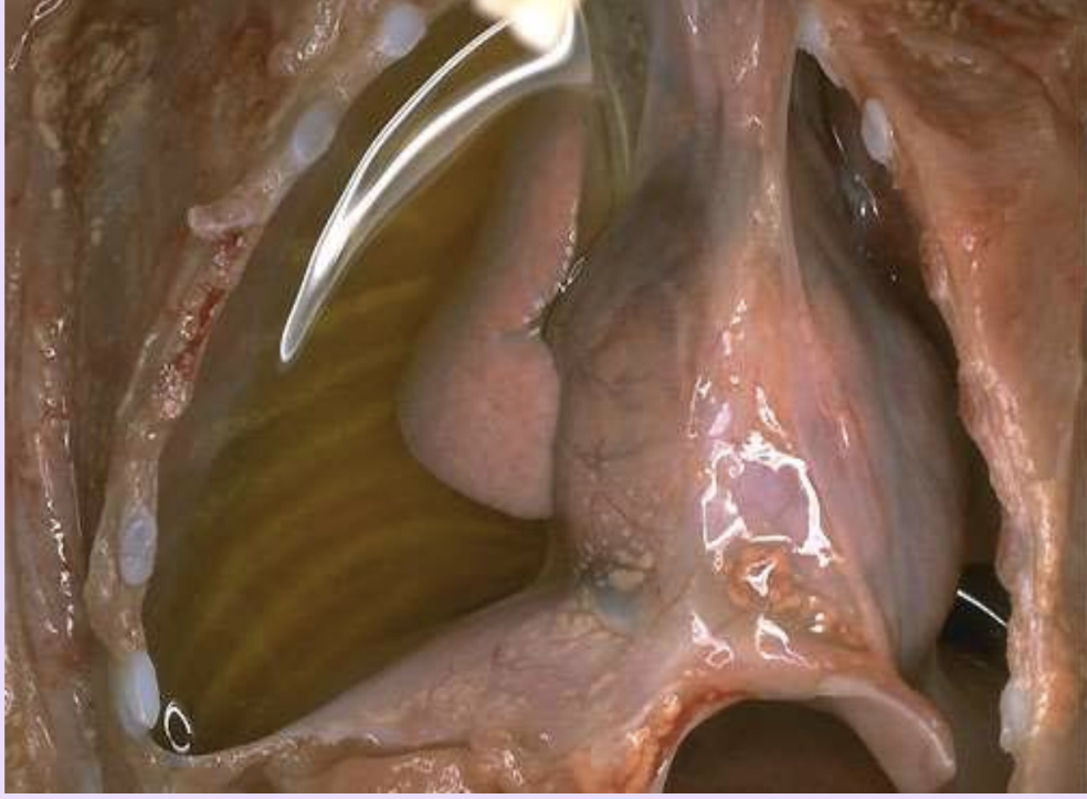 <p>Serous inflammation</p>