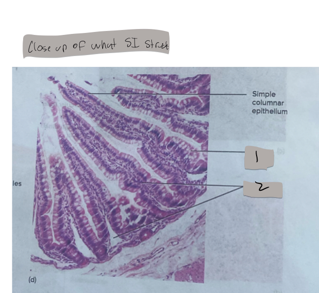 <p>this is close up of the __ of the SI</p>