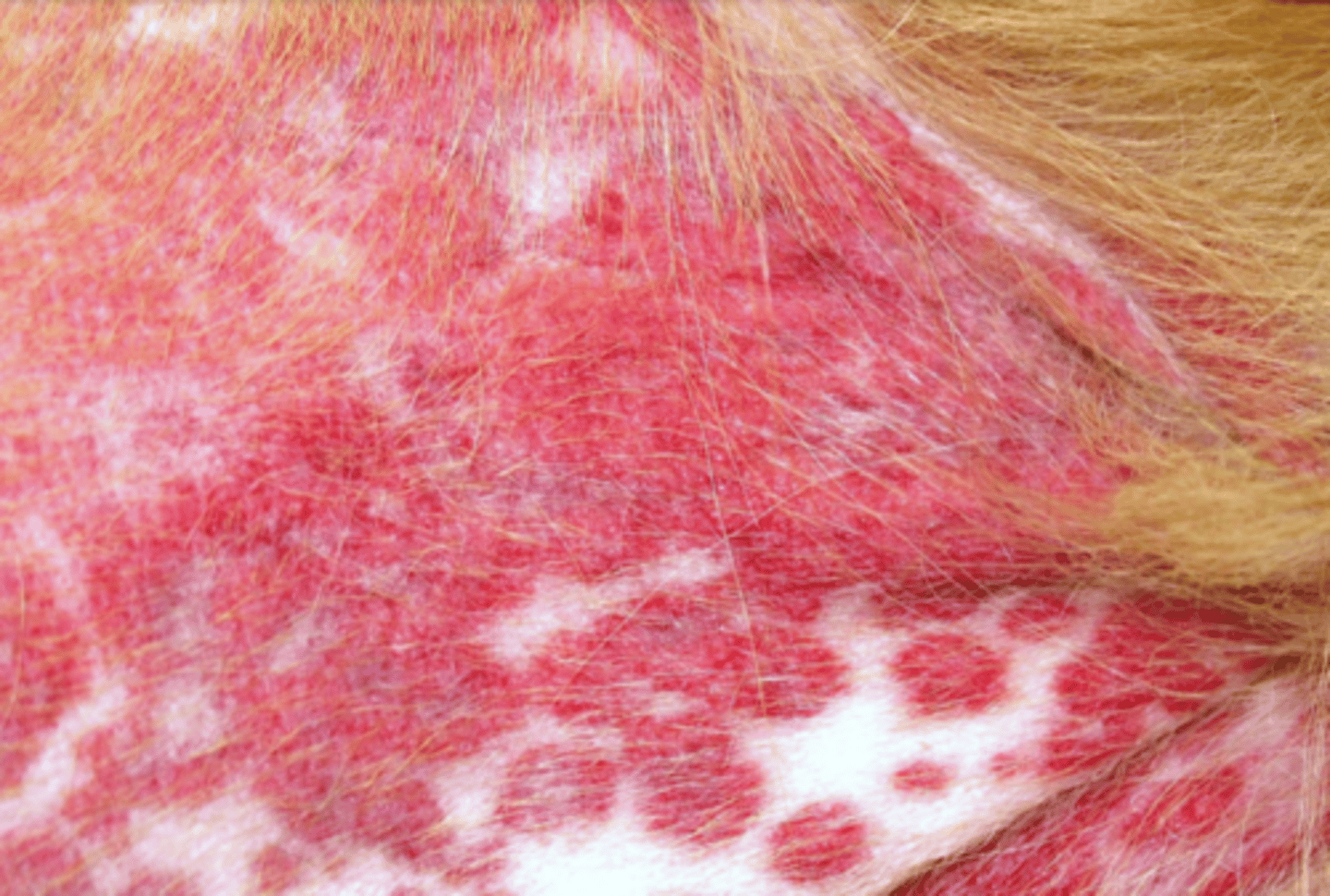 <p>What lesion is this? Is it primary or secondary?</p>