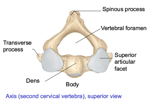 <p><span style="background-color: transparent;"><u><span>Axis</span></u><span>: “No” movement </span></span></p><ul><li><p><span style="background-color: transparent;"><span>Slight vertebral body </span></span></p></li><li><p><span style="background-color: transparent;"><u><span>Dens</span></u><span>: upward-facing long bony process that facilitates turning motions in C2 vertebra</span></span></p></li><li><p><span style="background-color: transparent;"><span>Transverse process – looks like “trailer hitch”</span></span></p></li><li><p><span style="background-color: transparent;"><span>Superior articular facet – is very flat and points up (to sky)</span></span></p></li><li><p><span style="background-color: transparent;"><span>Inferior articular facet — also flat points down (ground) </span></span></p><ul><li><p><span style="background-color: transparent;"><span>⤷ both when tog = have flat articulating surface, allows for large degree of cervical vertebrae </span></span></p></li></ul></li></ul><ul><li><p><span style="background-color: transparent;"><span>Slightly smaller vertebral foramen (compared to C1 atlas) </span></span></p></li><li><p><span style="background-color: transparent;"><span>Spinous process – has small projection</span></span></p></li></ul><p></p>