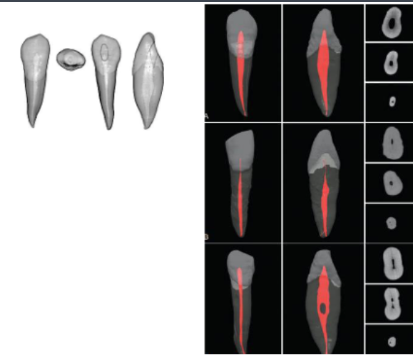 <p>LL than MD</p>