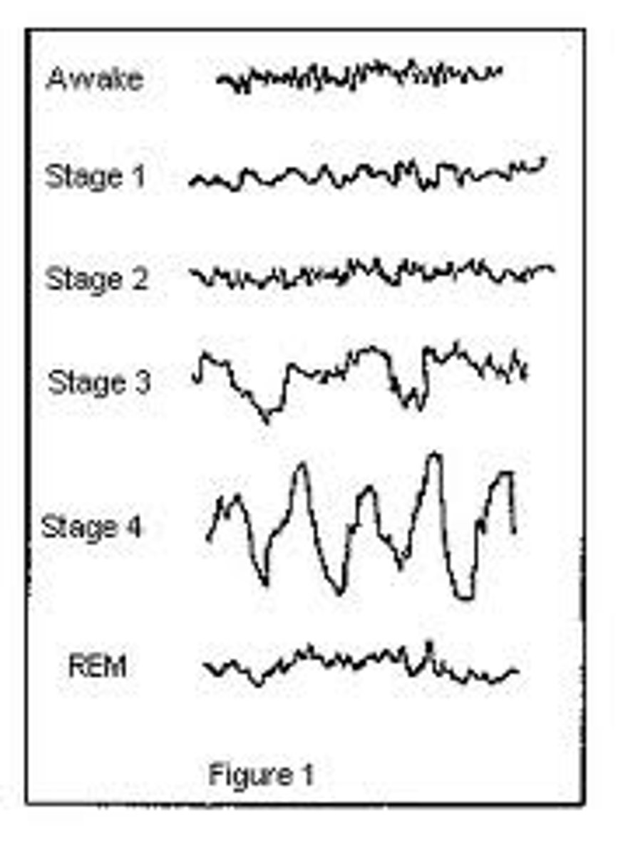 <p>Beta waves- Alert</p><p>Alpha waves- relaxed</p><p>Theta waves- early sleep stages</p><p>Delta waves- associated with deep sleep</p><p>Brain waves during REM are very active and more closely resemble the beta waves that occur when we are awake.</p>