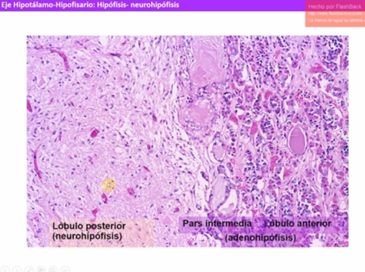 <p>Formada por: </p><ul><li><p>Axones amielinicos de neuronas hipotalamicas ( Haz hipotalamohipofisario). Nucelo paraventricular y supraoptico.</p></li><li><p>Elementos gliales: pituicitos</p></li><li><p>Red de capilares fenestrados</p></li></ul><p><strong>Funcion</strong>: sitio de almacenamiento y liberación de neurohormonas hipotalámicas (oxitocina, ADH)</p><p><strong>Cuerpos de herring</strong>: dilataciones a lo largo del axón y terminal axónico que contienen granulos neurosecretores.</p><p>Hormonas liberadas en la neurohipofisis</p><ul><li><p><strong>Oxitocina</strong>: promueve la contraccion del utero durante el parto. Media el reflejo de eyeccion de leche (induce contraccion de las celulas mioepiteliales en los alveolos glandulares</p></li><li><p><strong>Vasopresina</strong> ( H antidiuretica ADH): regulacion de los nivekes hidrici y osmotico. Promueve la <u>reabsorcion de agua </u>en el riñon </p></li></ul><p></p><p><strong>Pituicitos</strong></p><ul><li><p>Celulas gliales estrelladas</p></li><li><p>25% del volumen de la pars nerviosa</p></li><li><p>Forman una red entre los axones</p><p>Funcion trofica y de sosten, mantienen composicion ionica del liquido extracelular</p></li></ul>