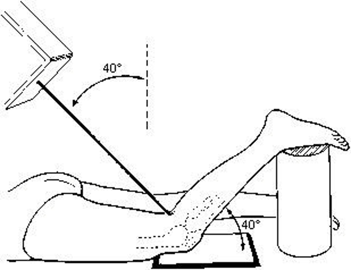 <p>The patient position and central-ray method demonstrated in the figure above is the:</p><p>Holmblad (intercondylar fossa)</p><p>Camp-Coventry (intercondylar fossa)</p><p>Settegast (patellofemoral joint)</p><p>Hughston (patellofemoral joint)</p>
