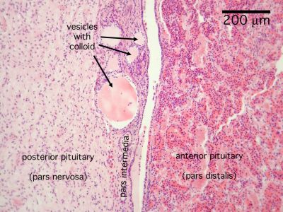 <ul><li><p class="Paragraph SCXW30549672 BCX0"><span>Posterior Pituitary Gland&nbsp;</span></p><ul><li><p class="Paragraph SCXW30549672 BCX0"><span>Antidiuretic hormone (ADH)&nbsp;</span></p><ul><li><p class="Paragraph SCXW30549672 BCX0"><span>Decrease urine production&nbsp;</span></p></li><li><p class="Paragraph SCXW30549672 BCX0"><span>Stimulates thirst&nbsp;</span></p></li><li><p class="Paragraph SCXW30549672 BCX0"><span>Constricts blood vessels&nbsp;</span></p></li></ul></li><li><p class="Paragraph SCXW30549672 BCX0"><span>Oxytocin (OT)&nbsp;</span></p><ul><li><p class="Paragraph SCXW30549672 BCX0"><span>Uterine contraction&nbsp;</span></p></li><li><p class="Paragraph SCXW30549672 BCX0"><span>Milk ejection&nbsp;</span></p></li><li><p class="Paragraph SCXW30549672 BCX0"><span>Emotional bonding&nbsp;</span></p></li></ul></li></ul></li><li><p class="Paragraph SCXW99832049 BCX0"><span>Anterior Pituitary Gland&nbsp;</span></p><ul><li><p class="Paragraph SCXW99832049 BCX0"><span>Thyroid stimulating hormone (TSH)&nbsp;</span></p><ul><li><p class="Paragraph SCXW99832049 BCX0"><span>Stimulates the release of thyroid hormone (TH)&nbsp;</span></p></li><li><p class="Paragraph SCXW99832049 BCX0"><span>Metabolism&nbsp;</span></p></li></ul></li><li><p class="Paragraph SCXW99832049 BCX0"><span>Prolactin (PRL)&nbsp;</span></p><ul><li><p class="Paragraph SCXW99832049 BCX0"><span>Milk production&nbsp;</span></p></li><li><p class="Paragraph SCXW99832049 BCX0"><span>Mammary gland growth in females&nbsp;</span></p></li></ul></li><li><p class="Paragraph SCXW99832049 BCX0"><span>Follicle-stimulating hormone (FSH) and Luteinizing Hormone (LH)&nbsp;</span></p><ul><li><p class="Paragraph SCXW99832049 BCX0"><span>Females:&nbsp;</span></p><ul><li><p class="Paragraph SCXW99832049 BCX0"><span>Regulates ovarian development&nbsp;</span></p></li><li><p class="Paragraph SCXW99832049 BCX0"><span>Estrogen secretion&nbsp;</span></p></li></ul></li><li><p class="Paragraph SCXW99832049 BCX0"><span>Males:&nbsp;</span></p><ul><li><p class="Paragraph SCXW99832049 BCX0"><span>Sperm development&nbsp;</span></p></li><li><p class="Paragraph SCXW99832049 BCX0"><span>Testosterone secretion&nbsp;</span></p></li></ul></li></ul></li><li><p class="Paragraph SCXW99832049 BCX0"><span>Adrenocorticotropic Hormone (ACTH)&nbsp;</span></p><ul><li><p class="Paragraph SCXW99832049 BCX0"><span>Causes release of corticotropin by adrenal gland&nbsp;</span></p></li></ul></li><li><p class="Paragraph SCXW99832049 BCX0"><span>Growth Hormone (GH)&nbsp;</span></p><ul><li><p class="Paragraph SCXW99832049 BCX0"><span>Causes liver to secrete insulin-like growth factor 1 and 2&nbsp;</span></p></li></ul></li></ul></li></ul><p></p>