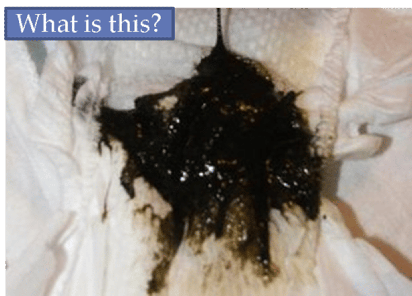 <p>-A Greenish-Black material formed mostly from amniotic fluid and sloughed-off cells that fills the fetal digestive system</p><p>-Part of the Digestive System</p>