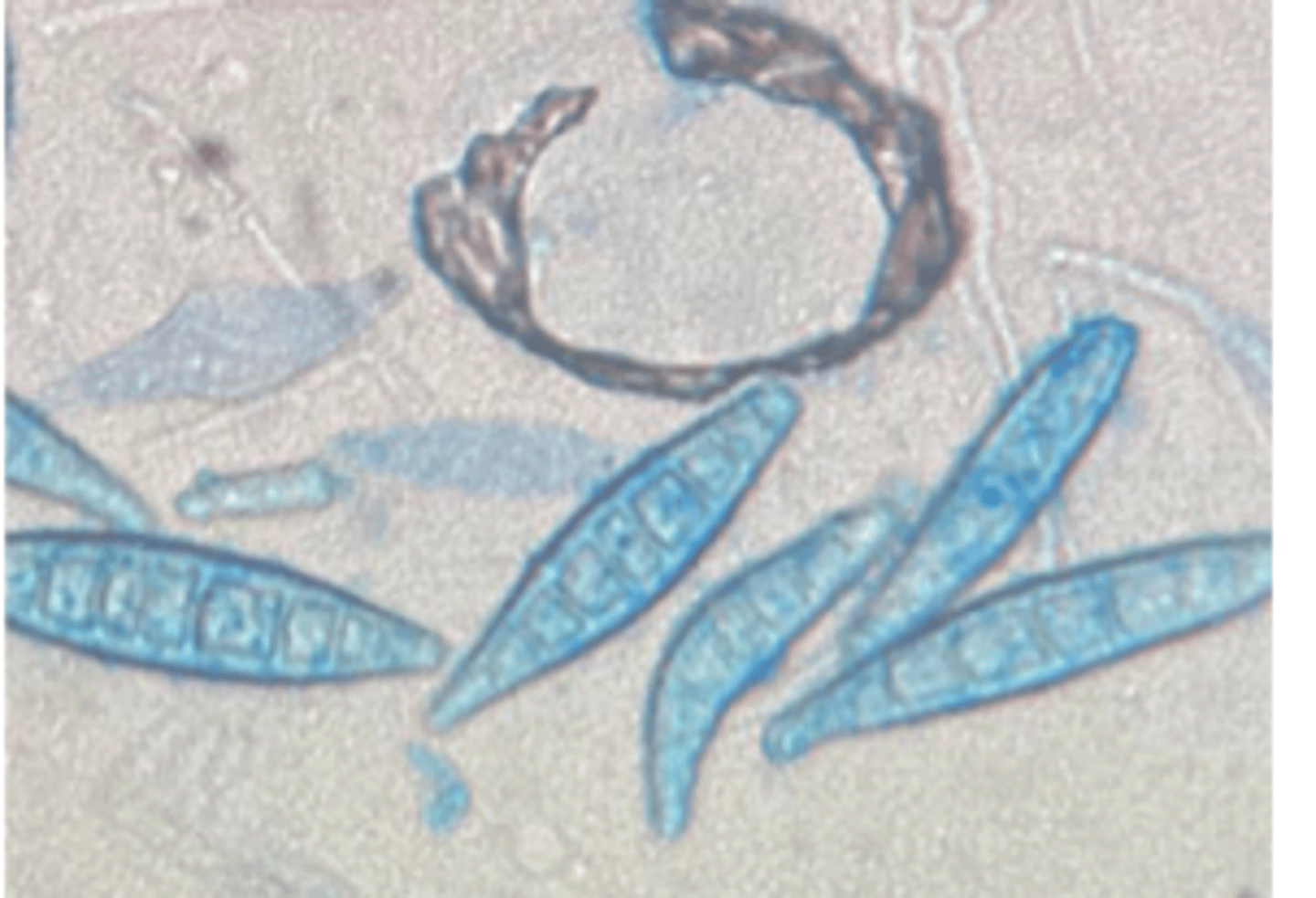 <p>LPCB-stained slide mount of _________ culture showing macroconidia.</p>