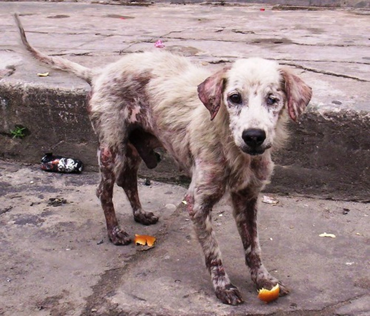 <p>Malnutrition</p>