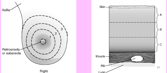 <p>ABC and 123 method on breast</p>