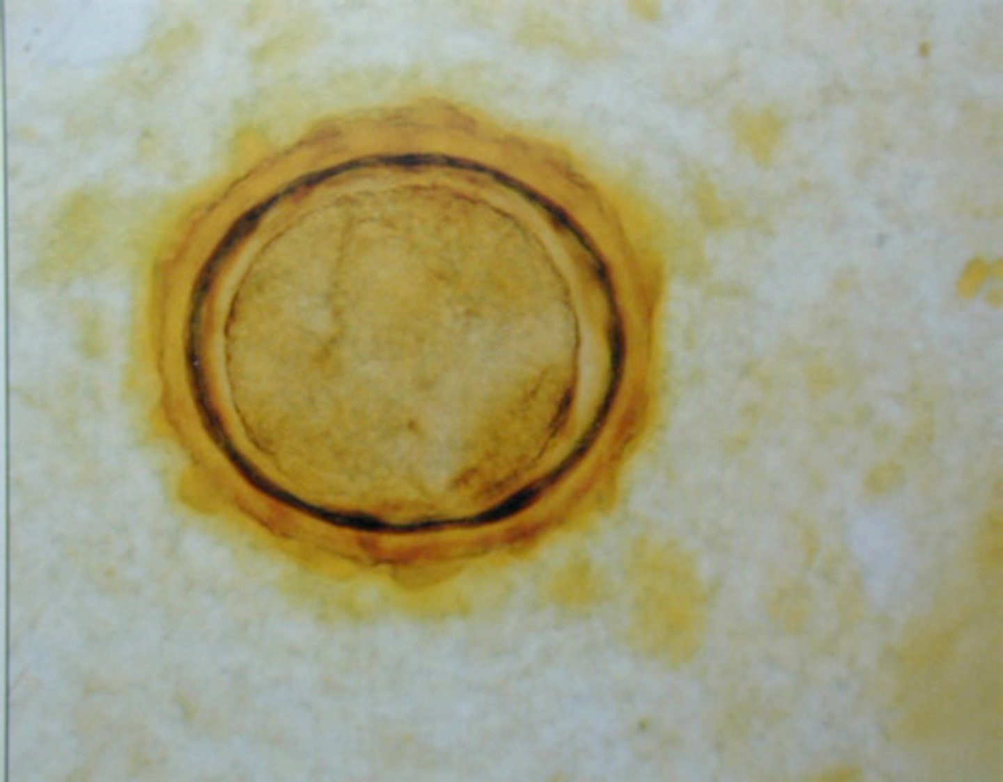 <p>egg</p>
