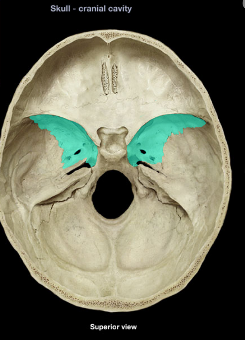 <p>what is highlighted/ sphenoid</p>