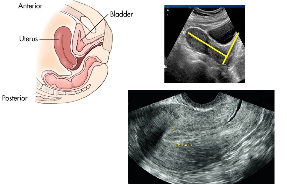 <p>MC uterine position </p>