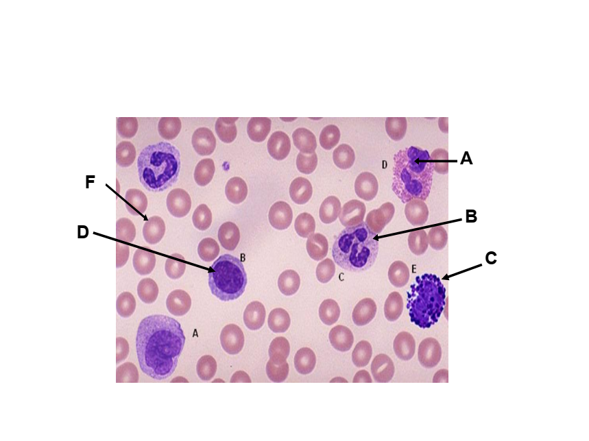 <p>ARROW LABELLED “F” IS POINTING</p>