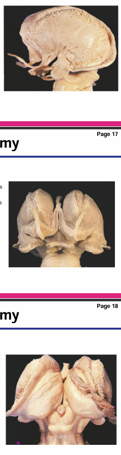 <p>Identify the caudate, putamen and amygdala</p>