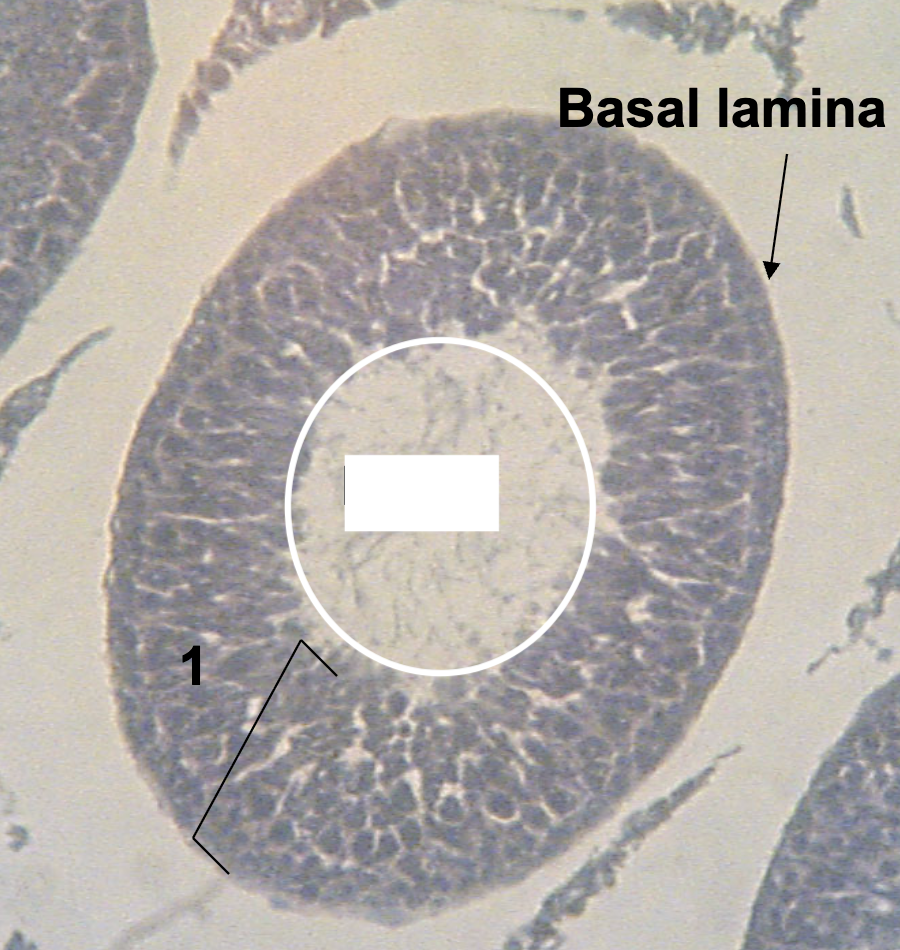 <p>What structure is being indicated by the white circle?</p>
