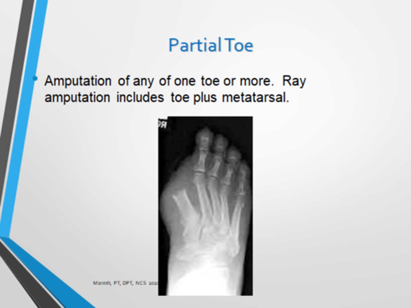 <p>Dysvasculatiry or trauma (frostbite, gangrene, infection)</p>