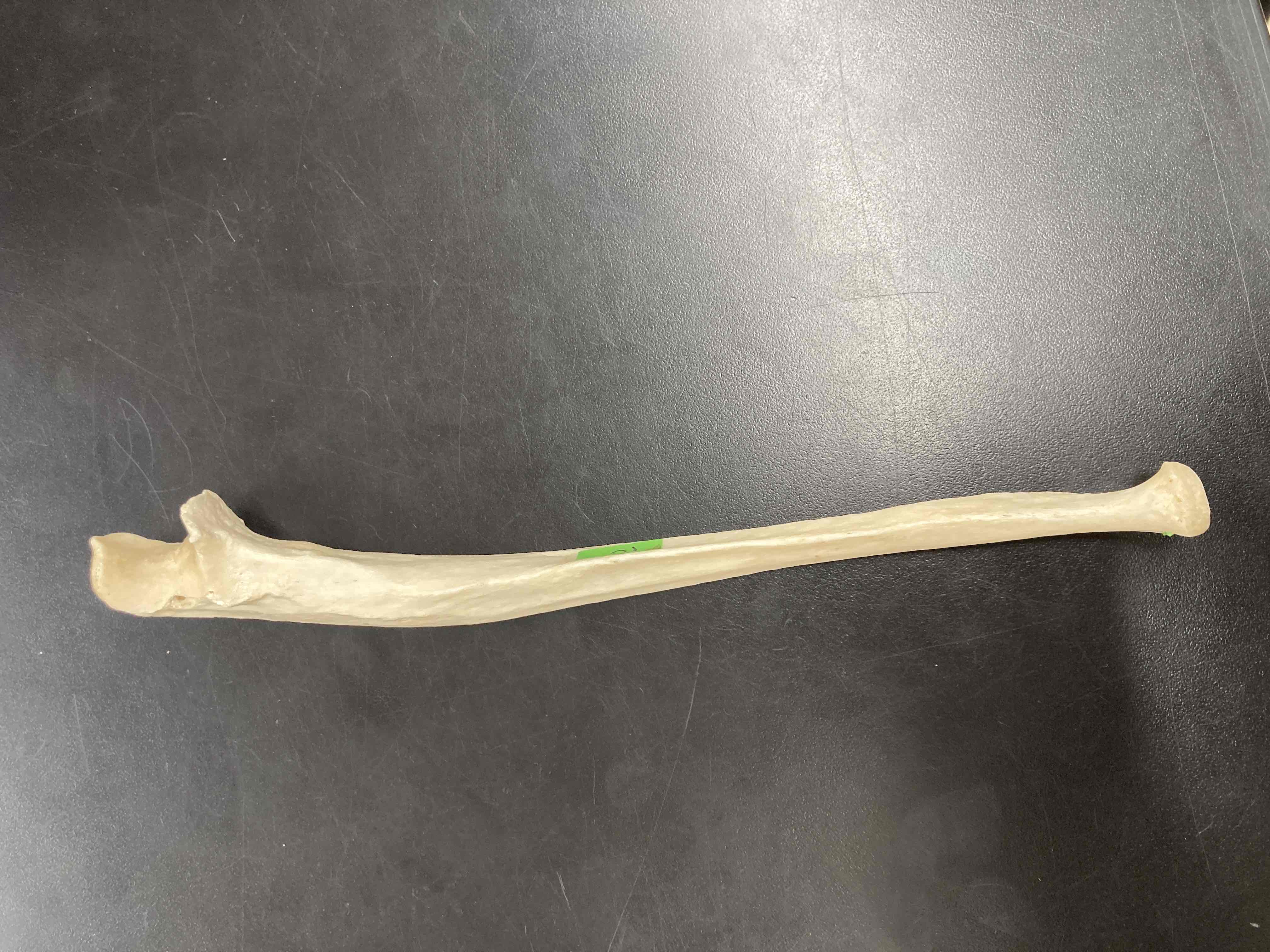 <p>What is the name of this bone?</p>