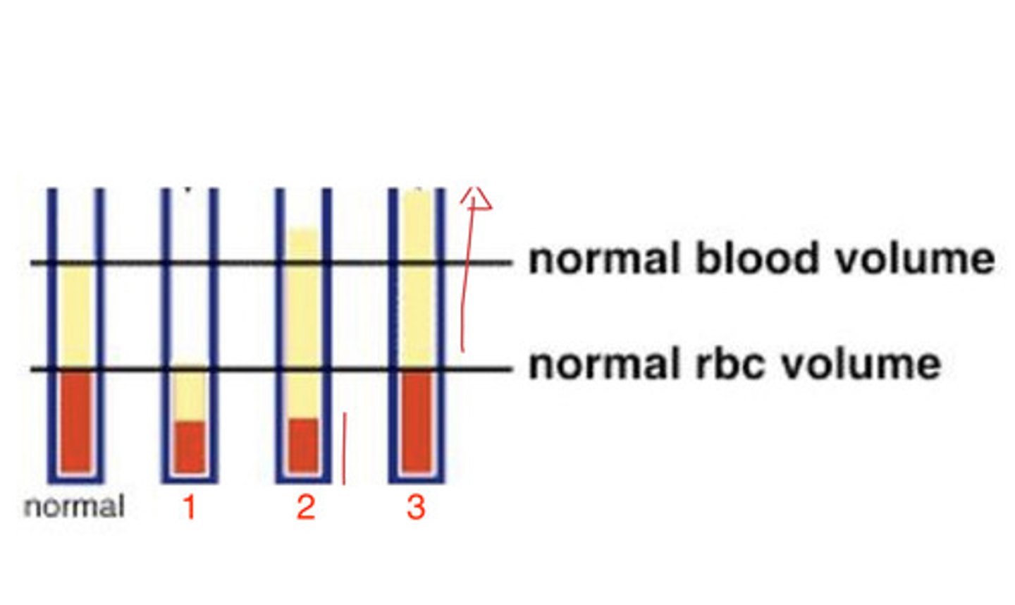 <p>which shows chronic hemorrhagic anemia?</p>