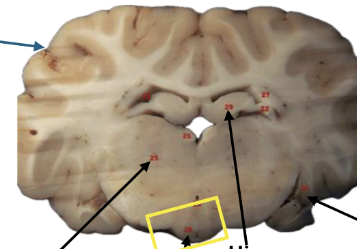 <p>What is this highlighted figure?</p>