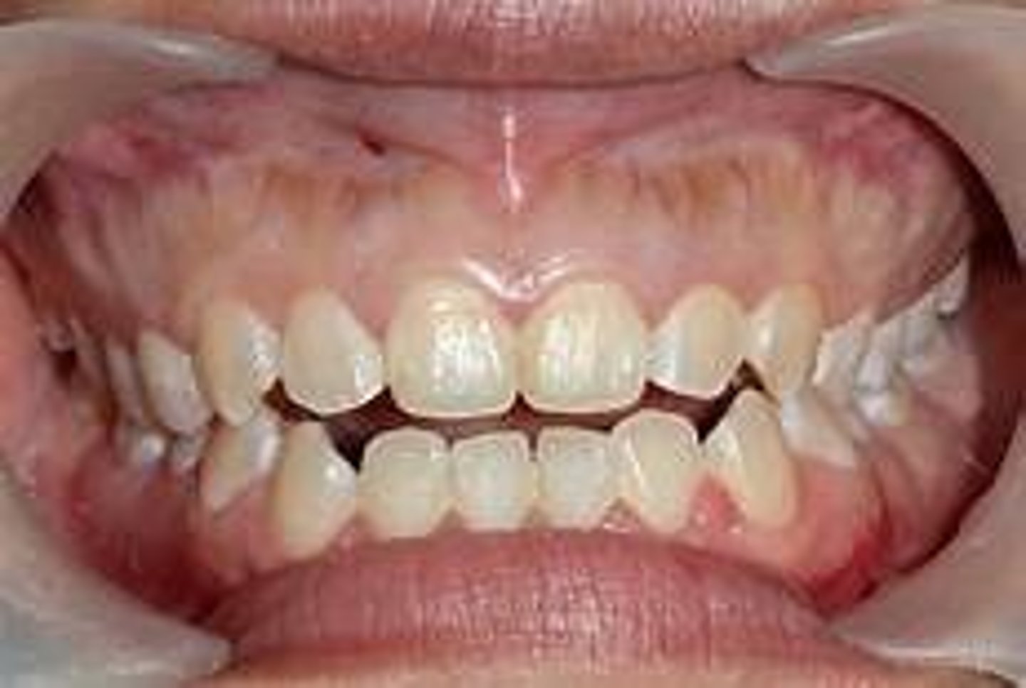 <p>This condition is called:</p>
